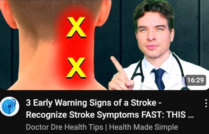 Stroke Stroke