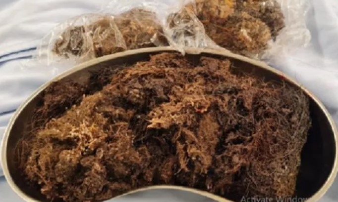 ăn tóc
