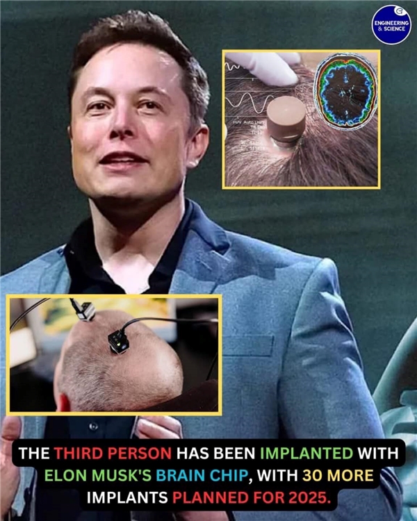 Neuralink